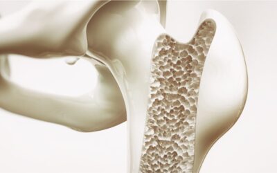 Menopausa e osteoporose: entenda a relação entre elas